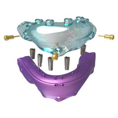 Img guía para implantes despiece