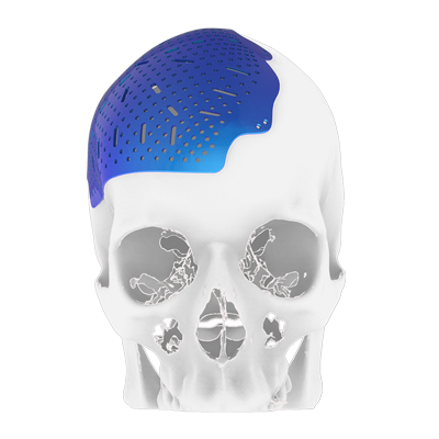 Img implante en titanio para reconstrucción ósea craneal vista frontal