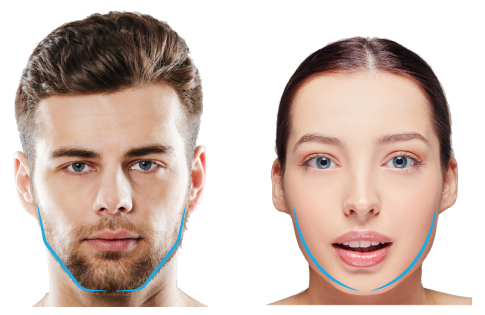 Img masculinización y feminización