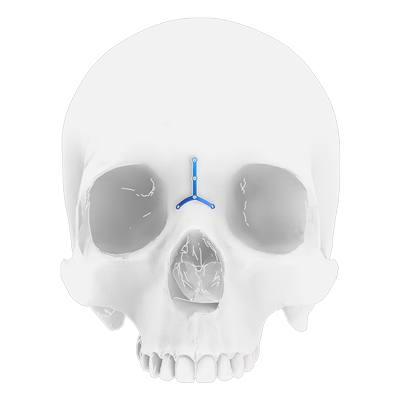 Img implante en titanio para fractura nasal 1
